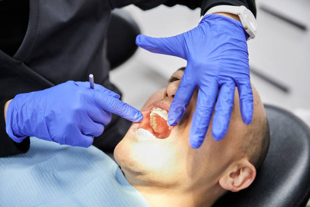 Best Emergency Wisdom Teeth Removal in Duenweg, MO