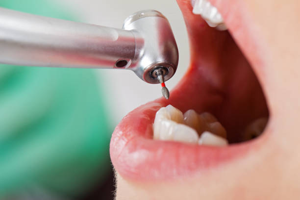 Best Same-Day Emergency Dentist in Duenweg, MO